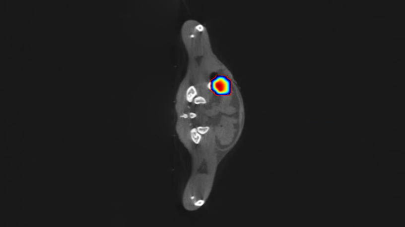 Automated Target Delineation