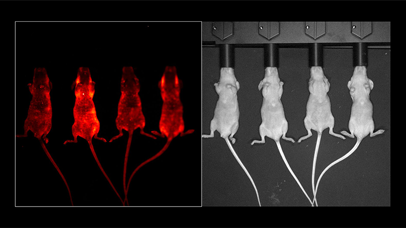 Dual-Filter Autofluorescence Correction