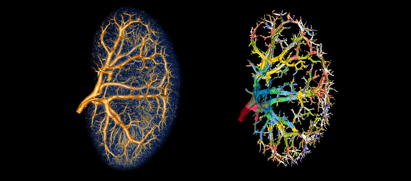 Vascular Analysis
