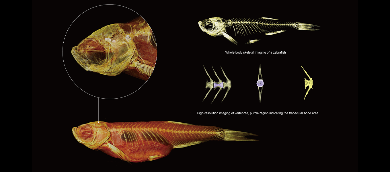 Bone Analysis