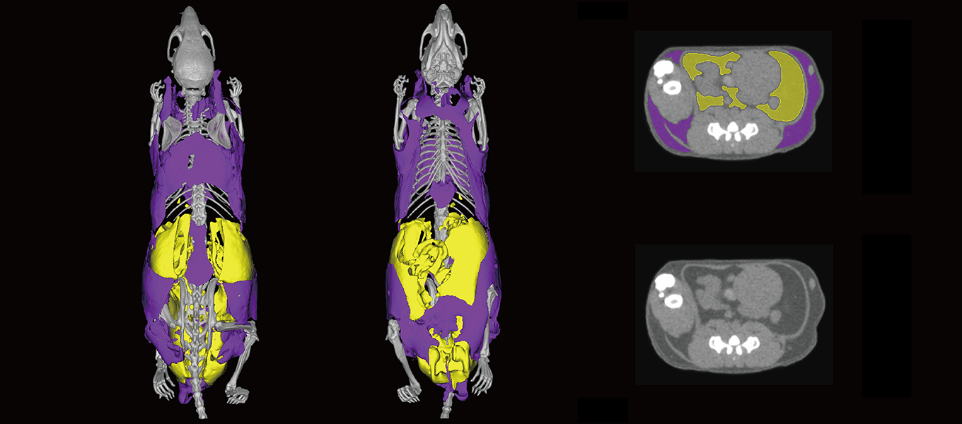 AI-Driven Adipose Tissue Analysis