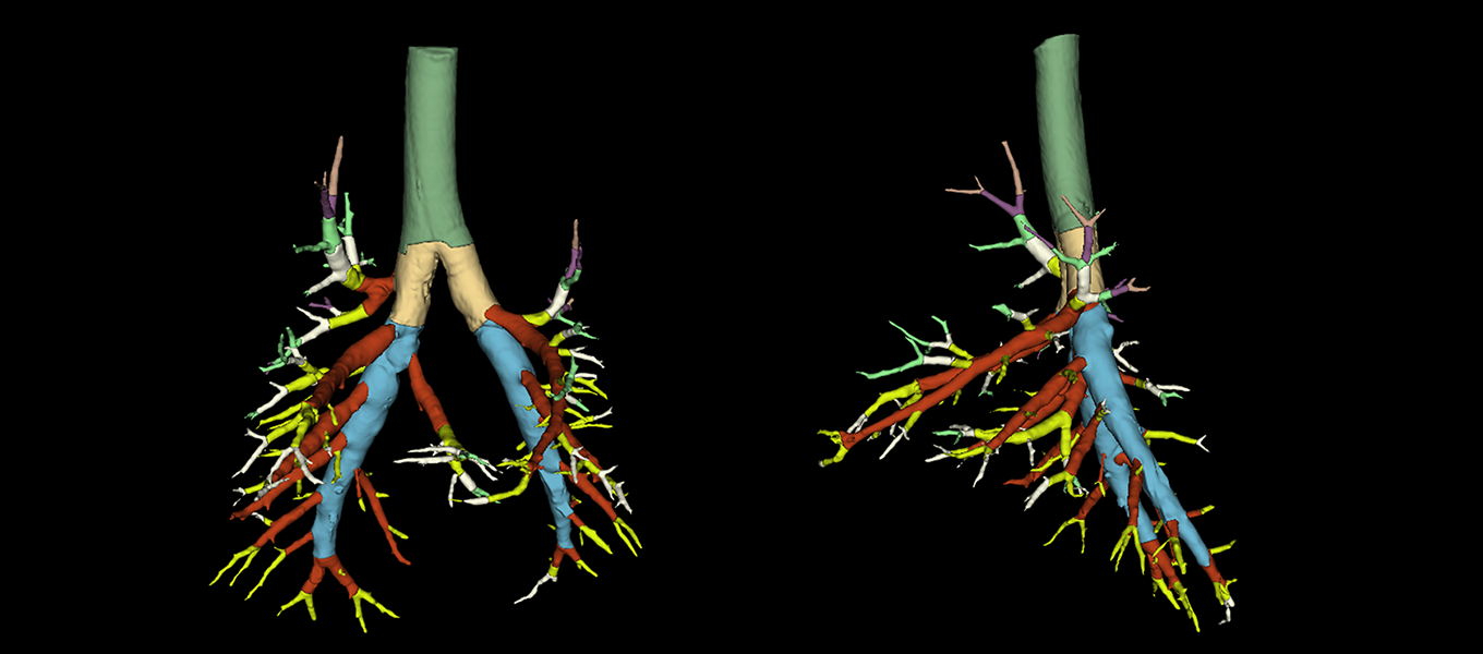 Multi-organ Intelligent Analysis