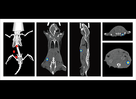 Optical Imaging Accurately Localizes Tumors Invisible to CT