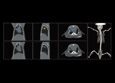 Precise Localization of Metastatic Tumors