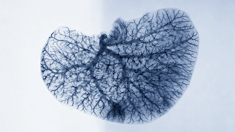 Next-Generation UHR Imaging