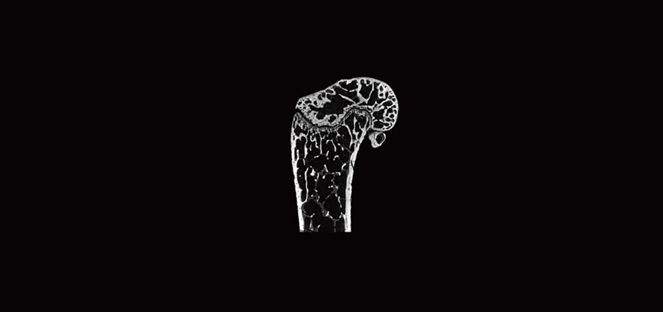 Micro-CT