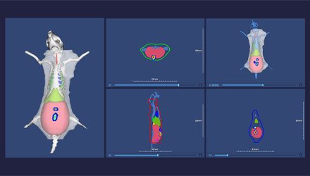 3D Optical Imaging of Systemic Tumor Signals with Precise Localization, Volume Quantification, and Organ Atlas.