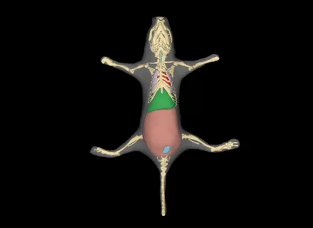AI-Driven Surface Generation, Organ Prediction, And Signal Reconstruction in One Workflow.