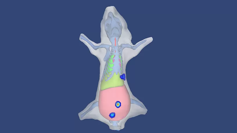 AI-Powered Organ Reconstruction