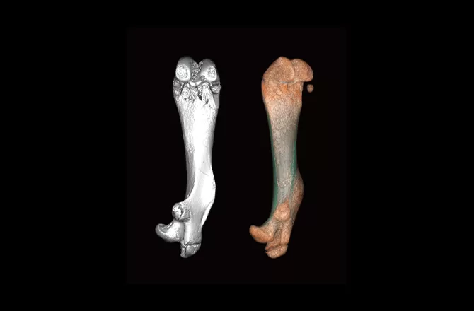 Bone Research