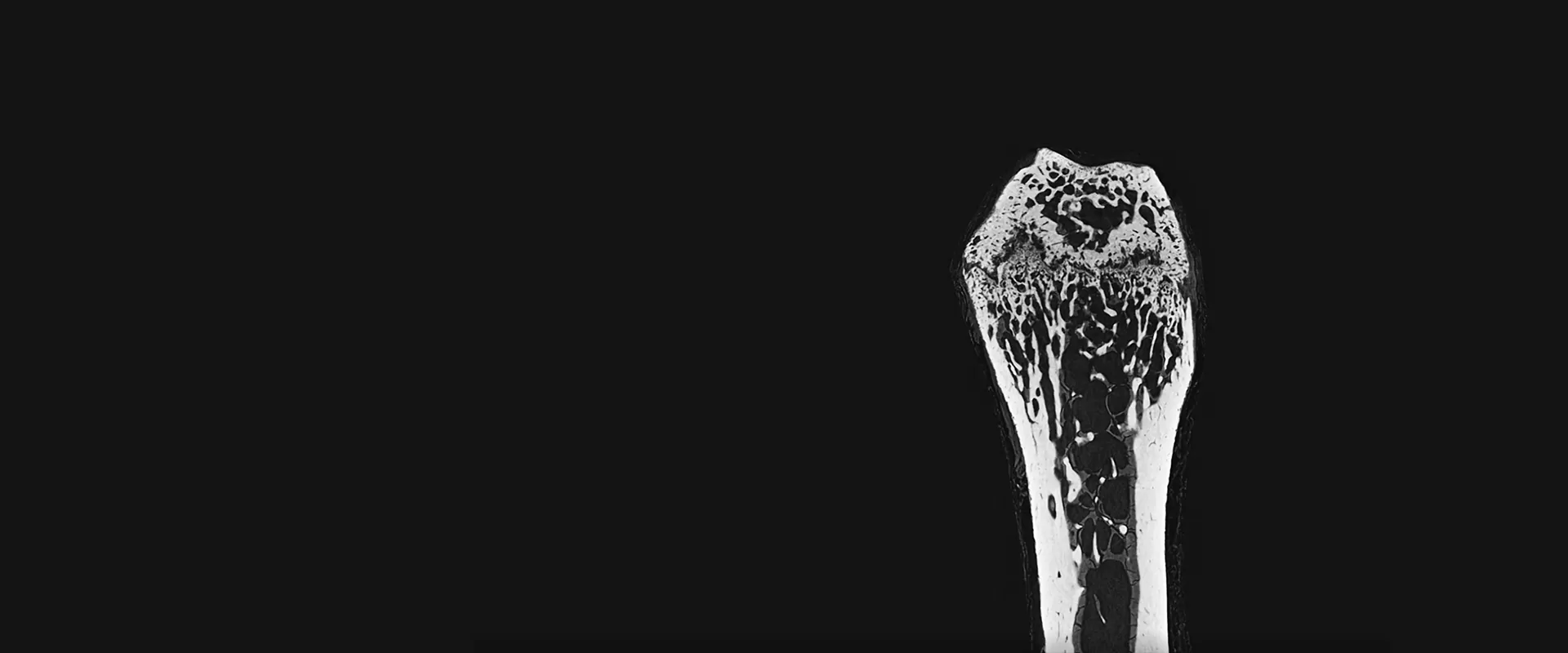 Raycision Micro-CT