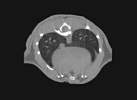 Lung Imaging