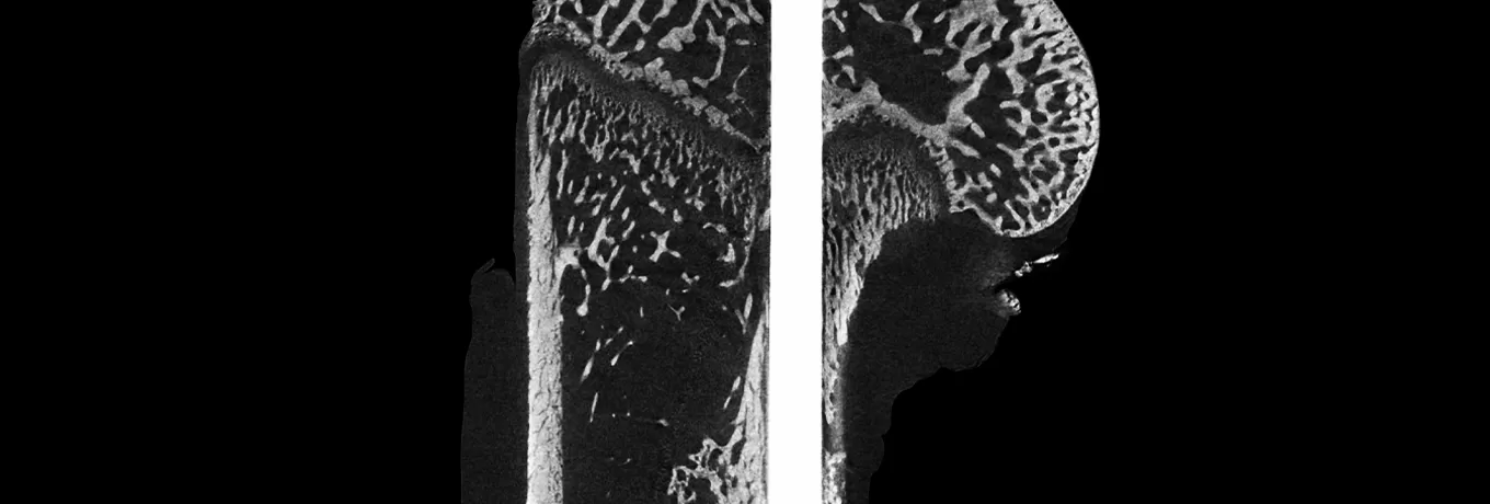 Advanced Micro-CT Imaging Solutions