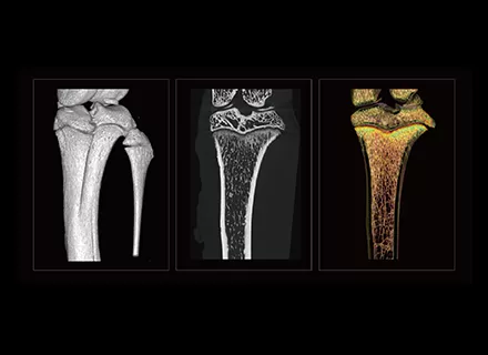 Mouse Tibia Imaging
