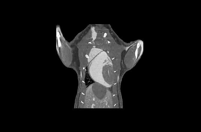 Soft Tissue and Organ Imaging