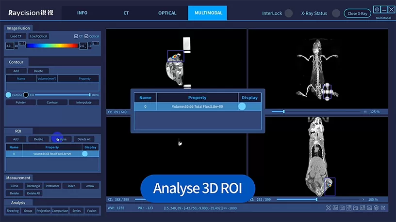AI-Powered Software: Automated ROI Analysis and Organ Segmentation